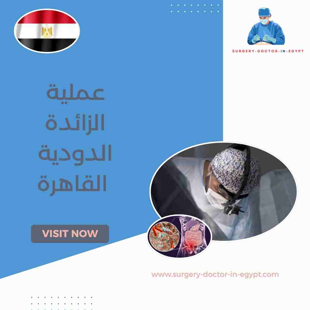 عملية الزائدة الدودية القاهرة