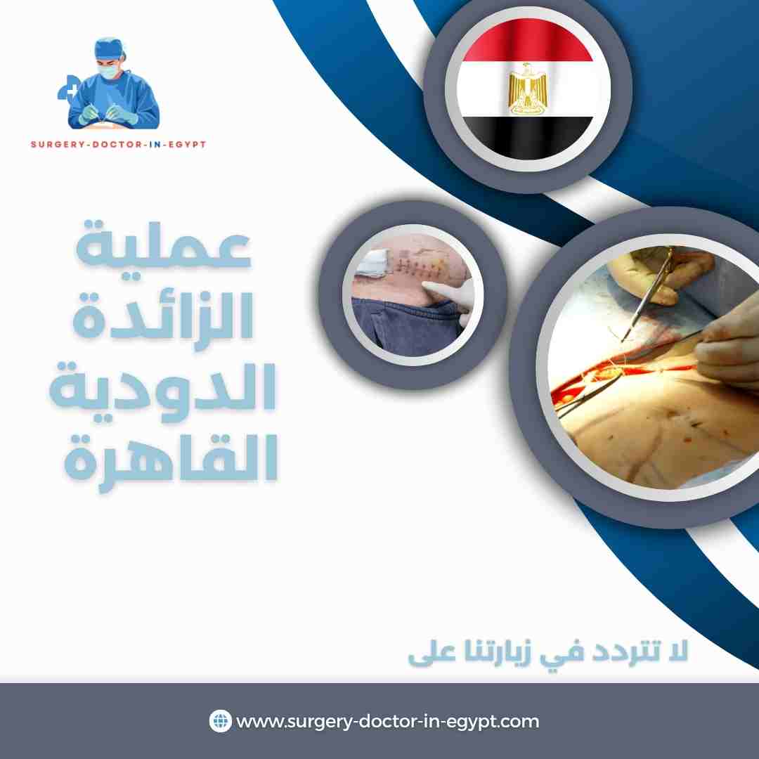 عملية الزائدة الدودية القاهرة