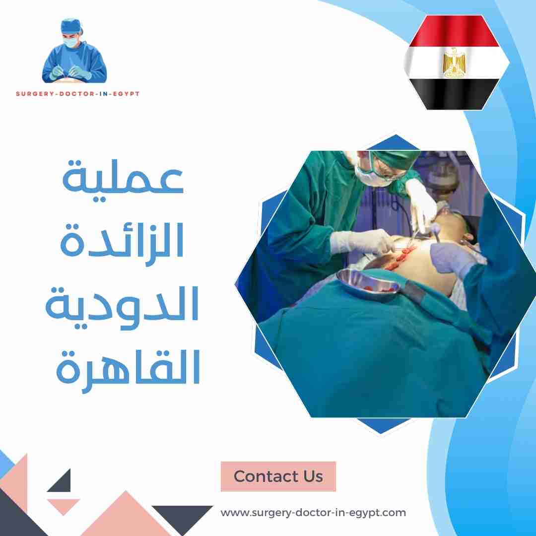 عملية الزائدة الدودية القاهرة