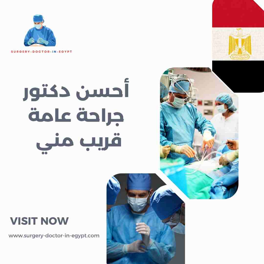 أحسن دكتور جراحة عامة قريب مني