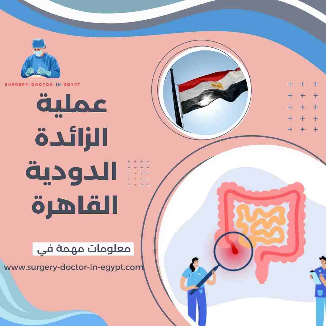عملية الزائدة الدودية القاهرة