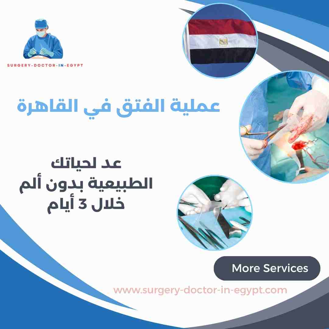 عملية الفتق في القاهرة