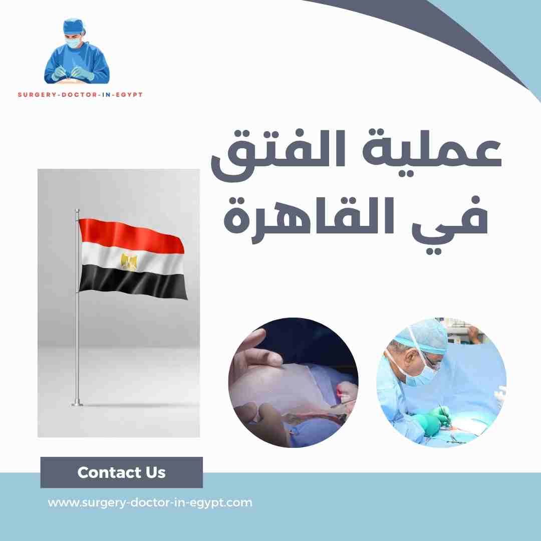 عملية الفتق في القاهرة