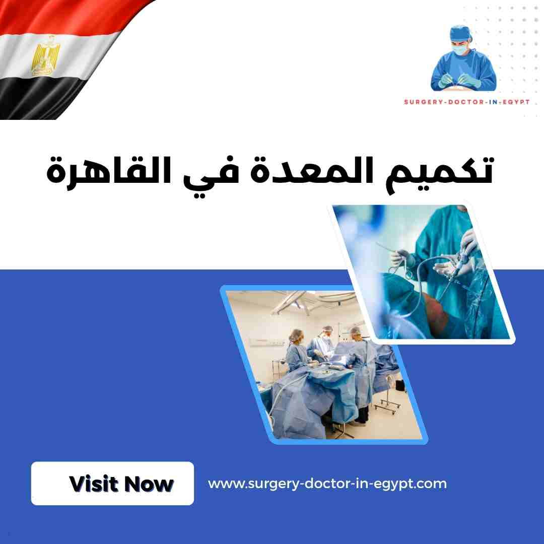 تكميم المعدة في القاهرة