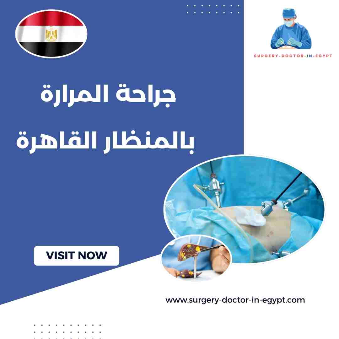 جراحة المرارة بالمنظار القاهرة