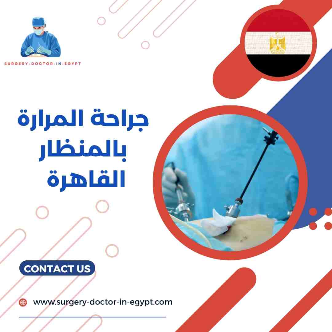 جراحة المرارة بالمنظار القاهرة