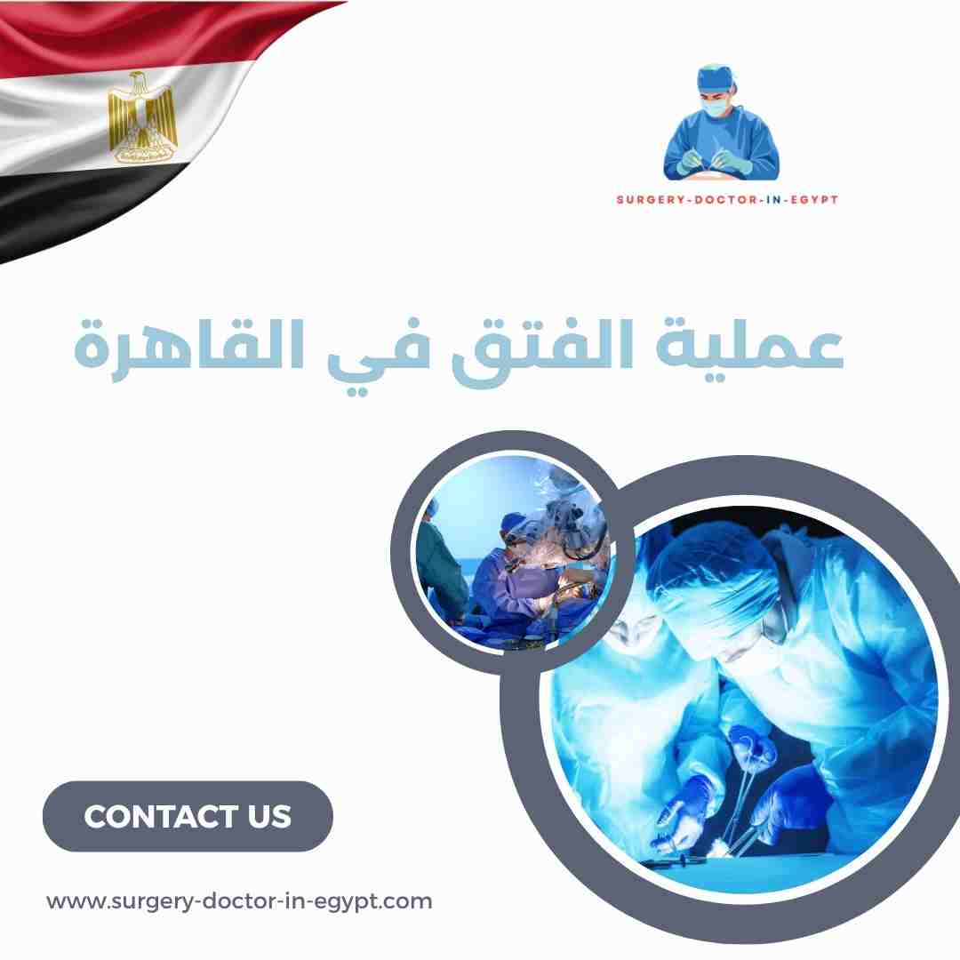 عملية الفتق في القاهرة