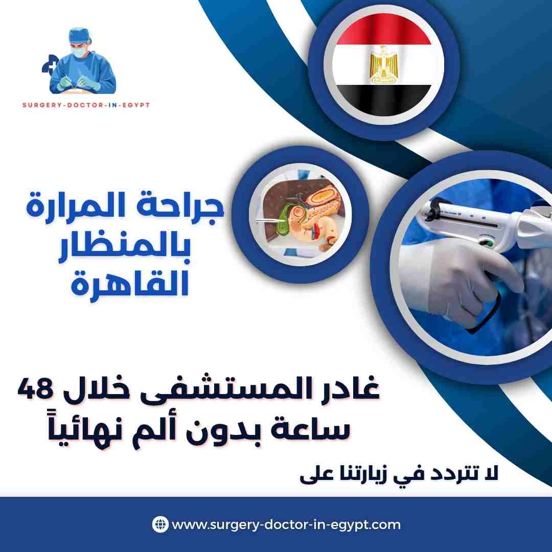 جراحة المرارة بالمنظار القاهرة