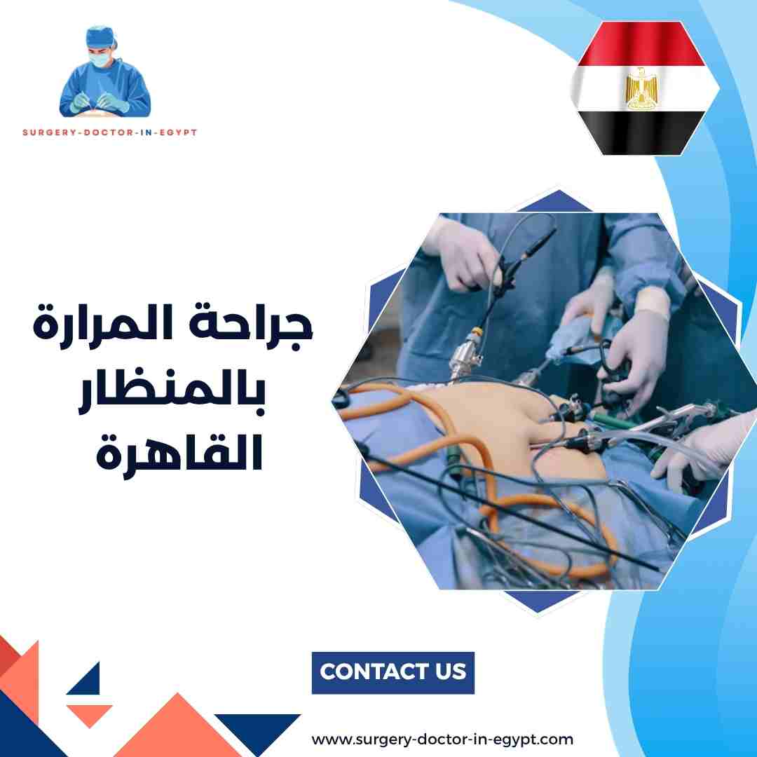 جراحة المرارة بالمنظار القاهرة