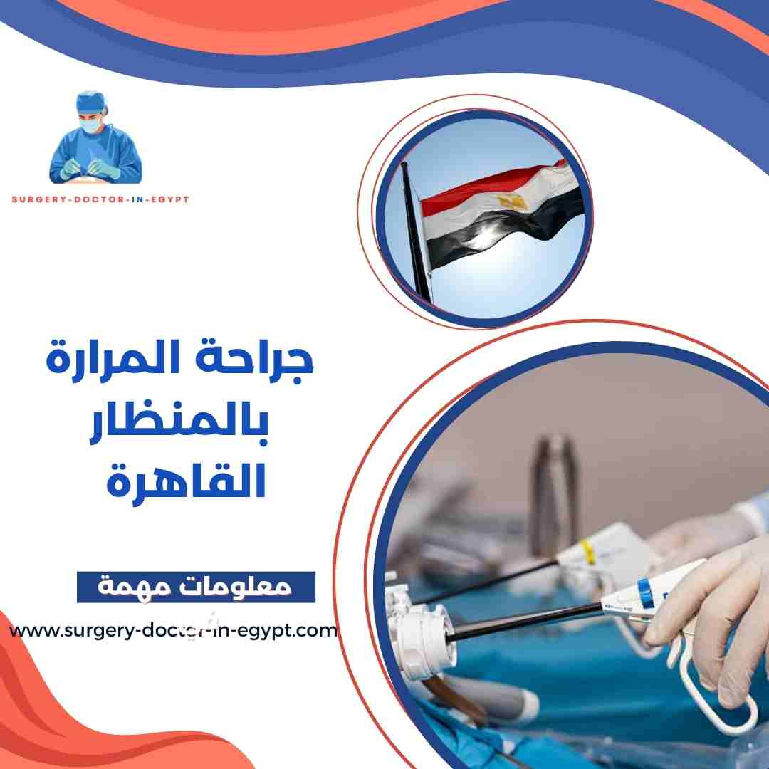 جراحة المرارة بالمنظار القاهرة