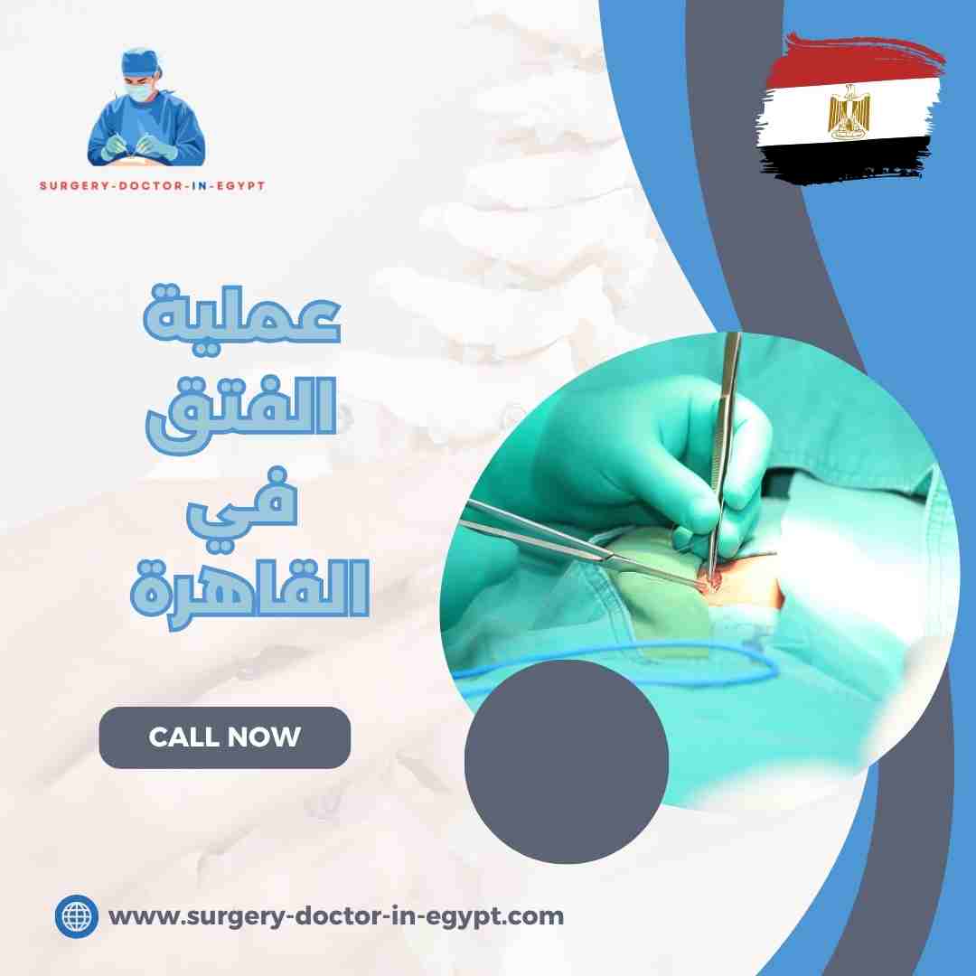 عملية الفتق في القاهرة