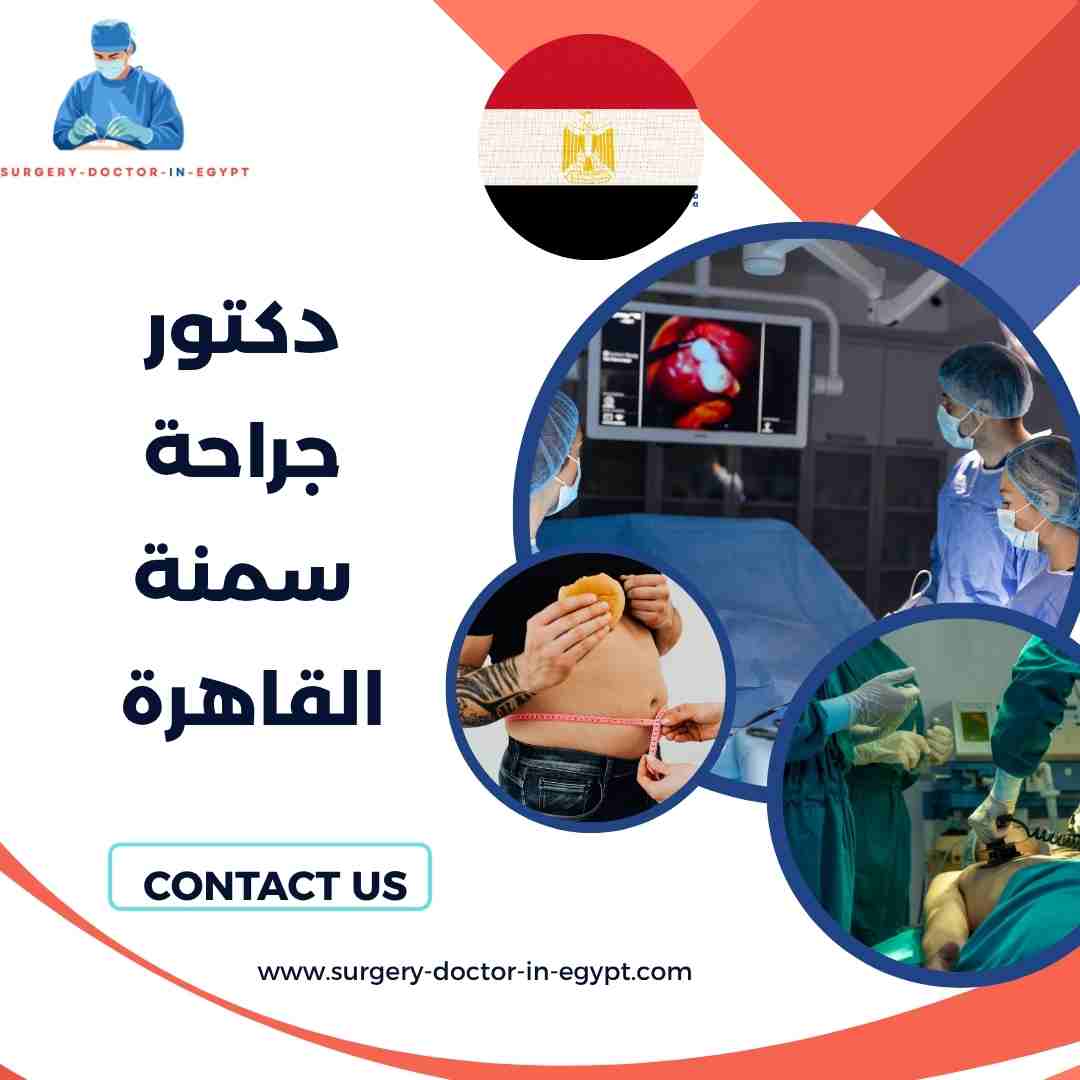 دكتور جراحة سمنة القاهرة
