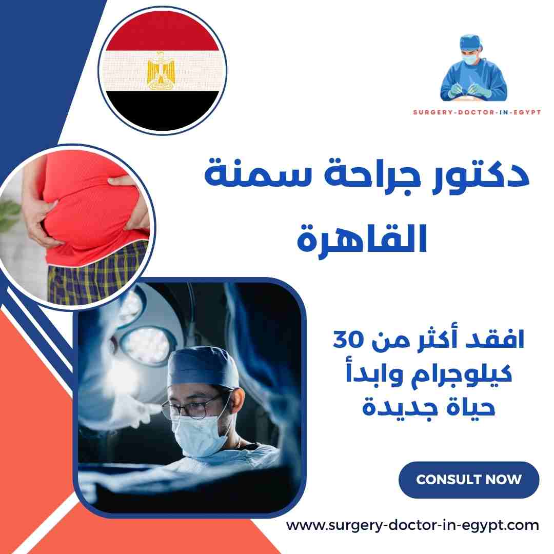 دكتور جراحة سمنة القاهرة