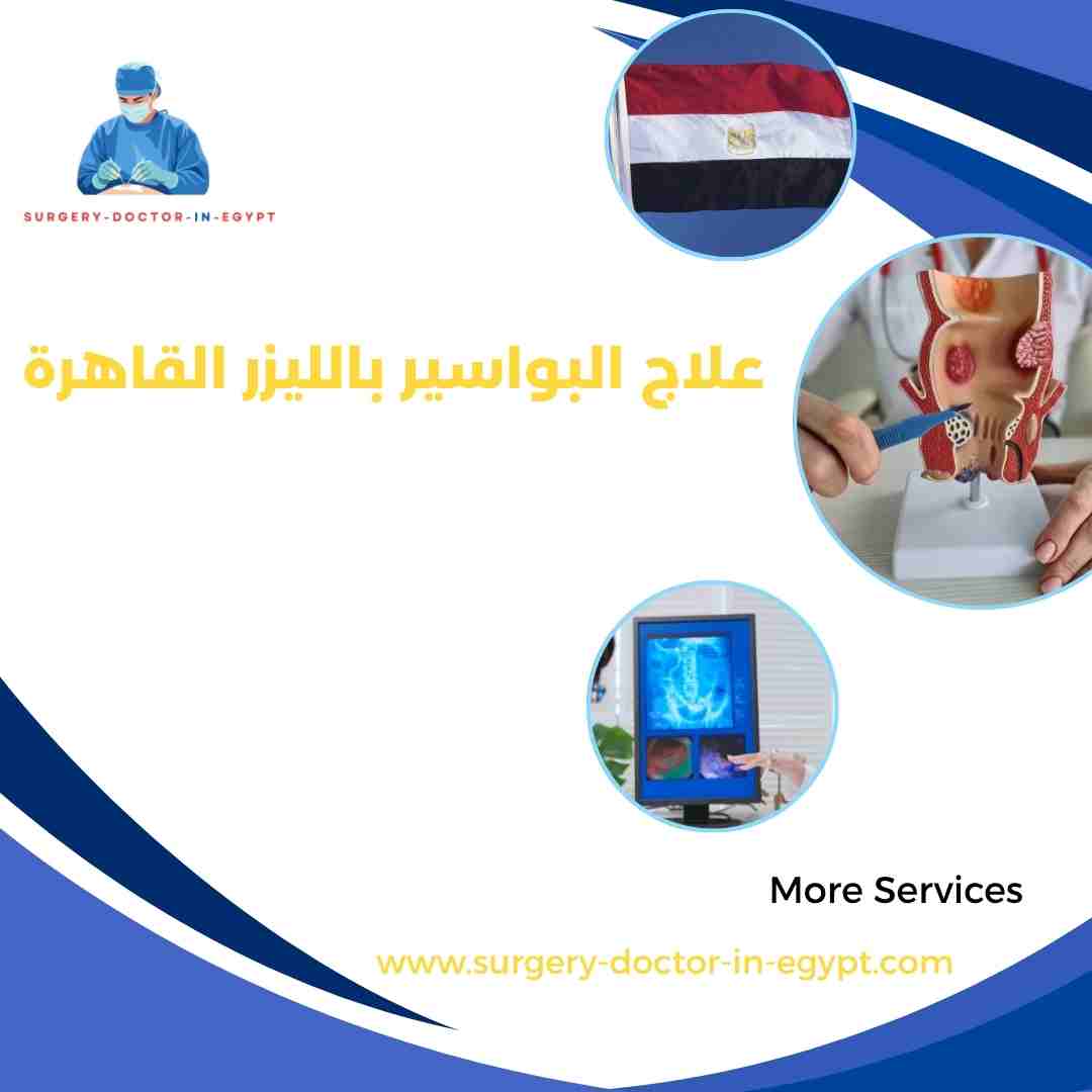 علاج البواسير بالليزر القاهرة