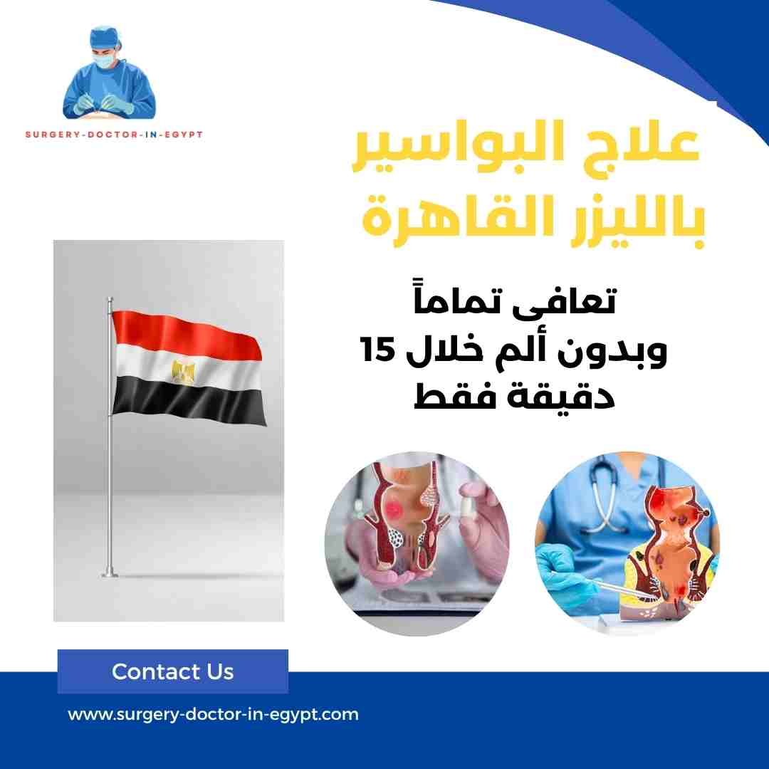 علاج البواسير بالليزر القاهرة
