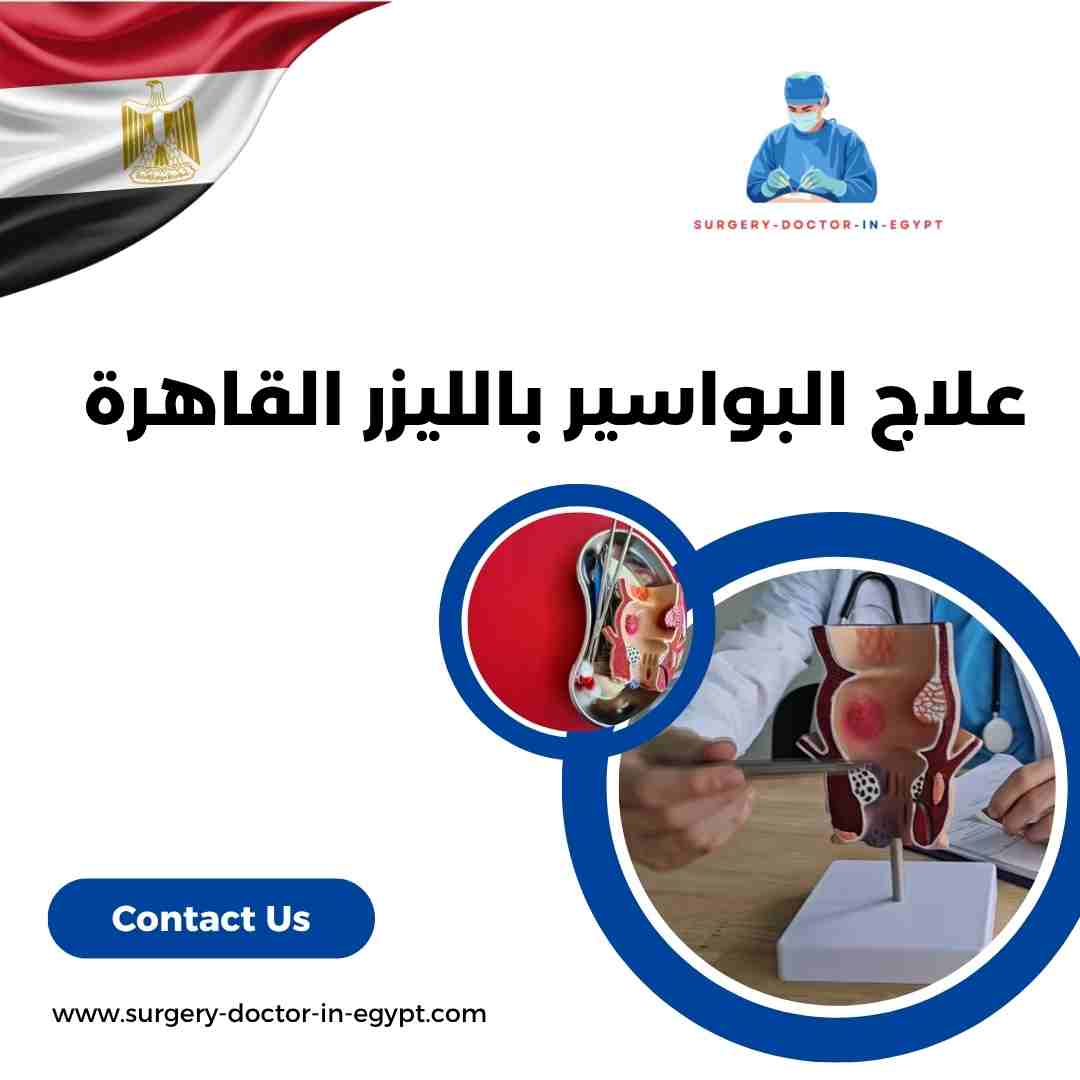 علاج البواسير بالليزر القاهرة