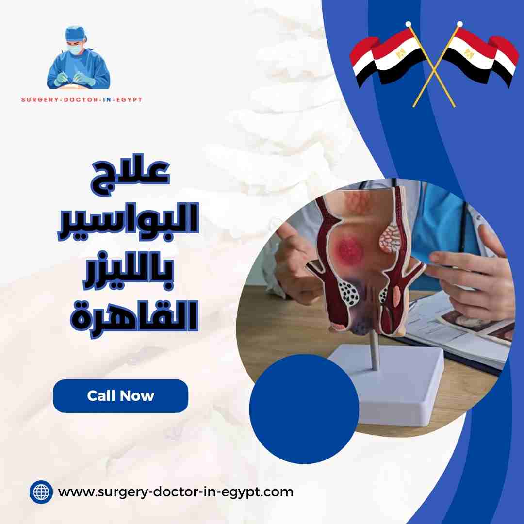 علاج البواسير بالليزر القاهرة