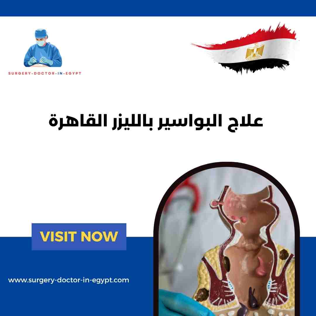 علاج البواسير بالليزر القاهرة