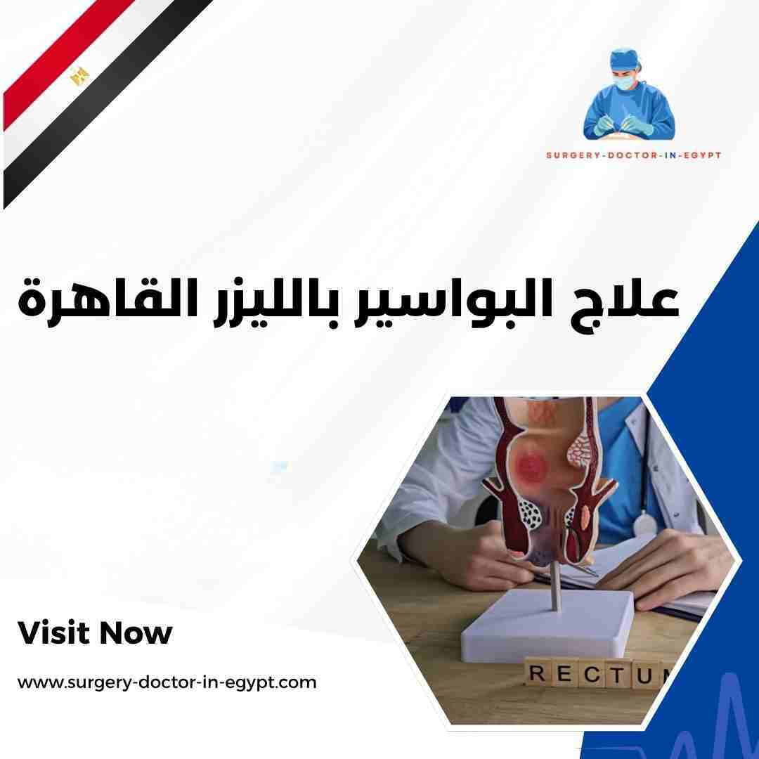 علاج البواسير بالليزر القاهرة