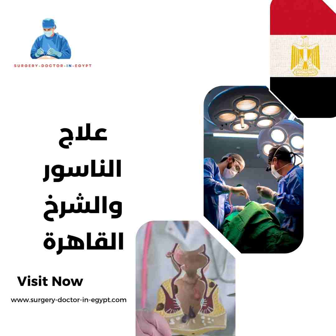 علاج الناسور والشرخ القاهرة