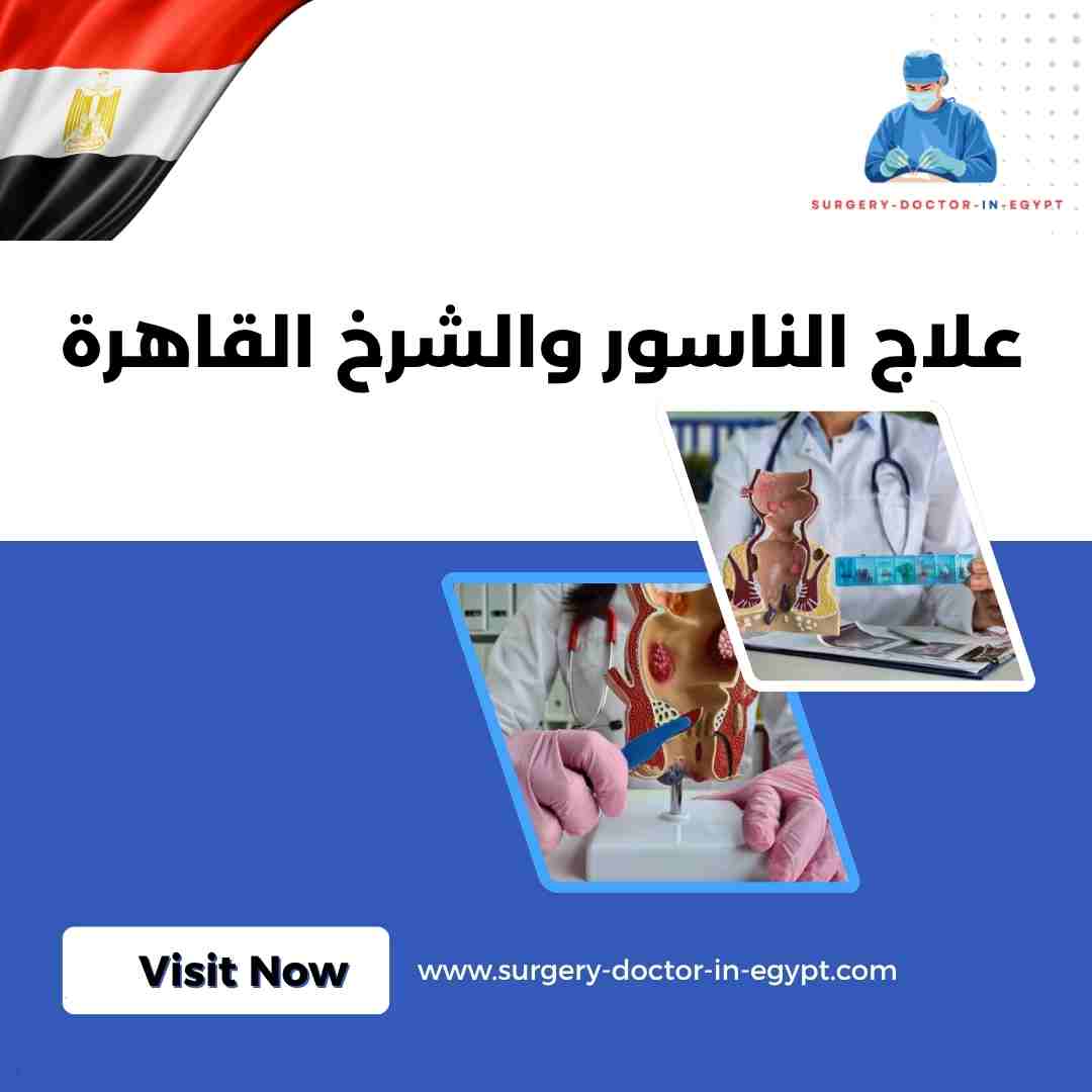 علاج الناسور والشرخ القاهرة