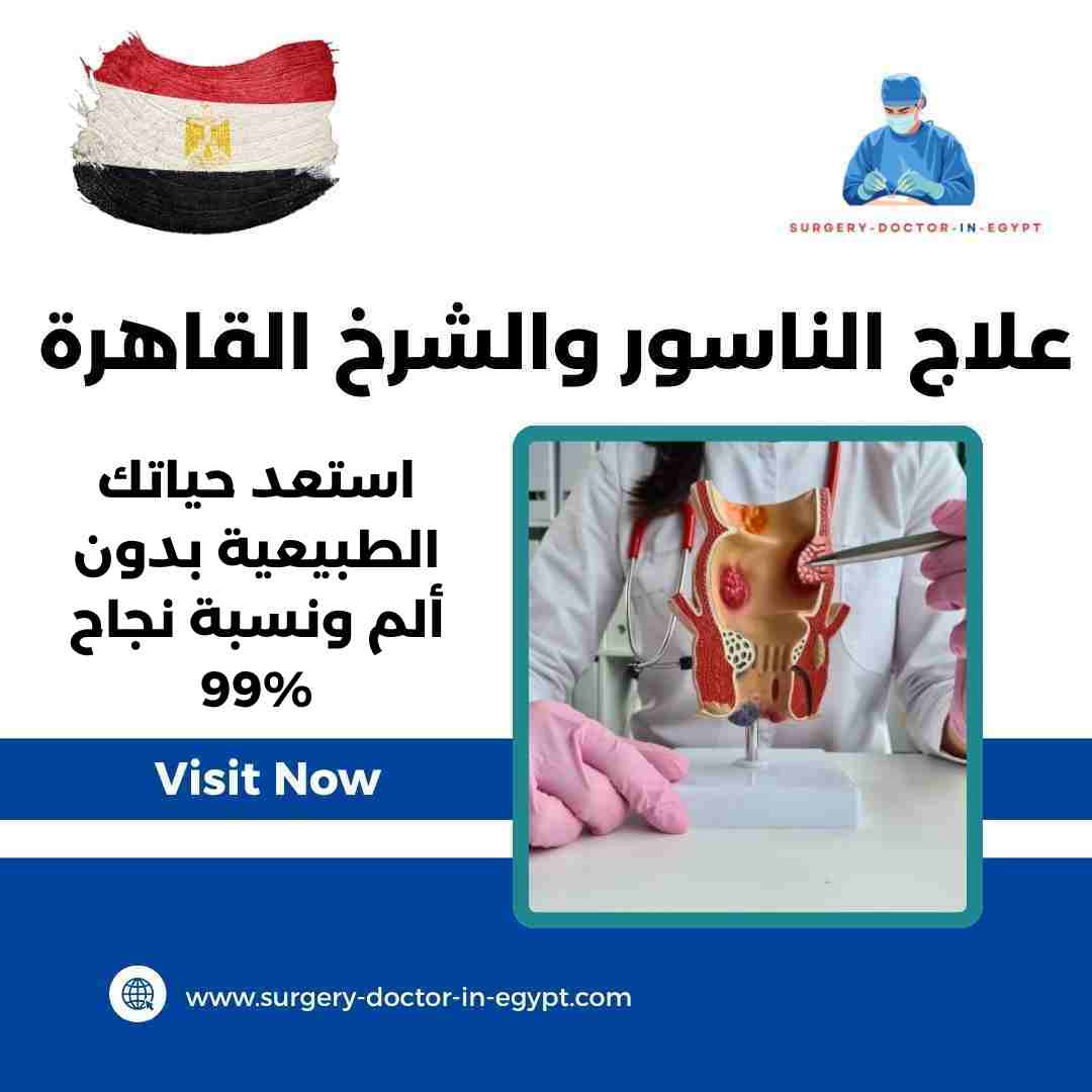 علاج الناسور والشرخ القاهرة