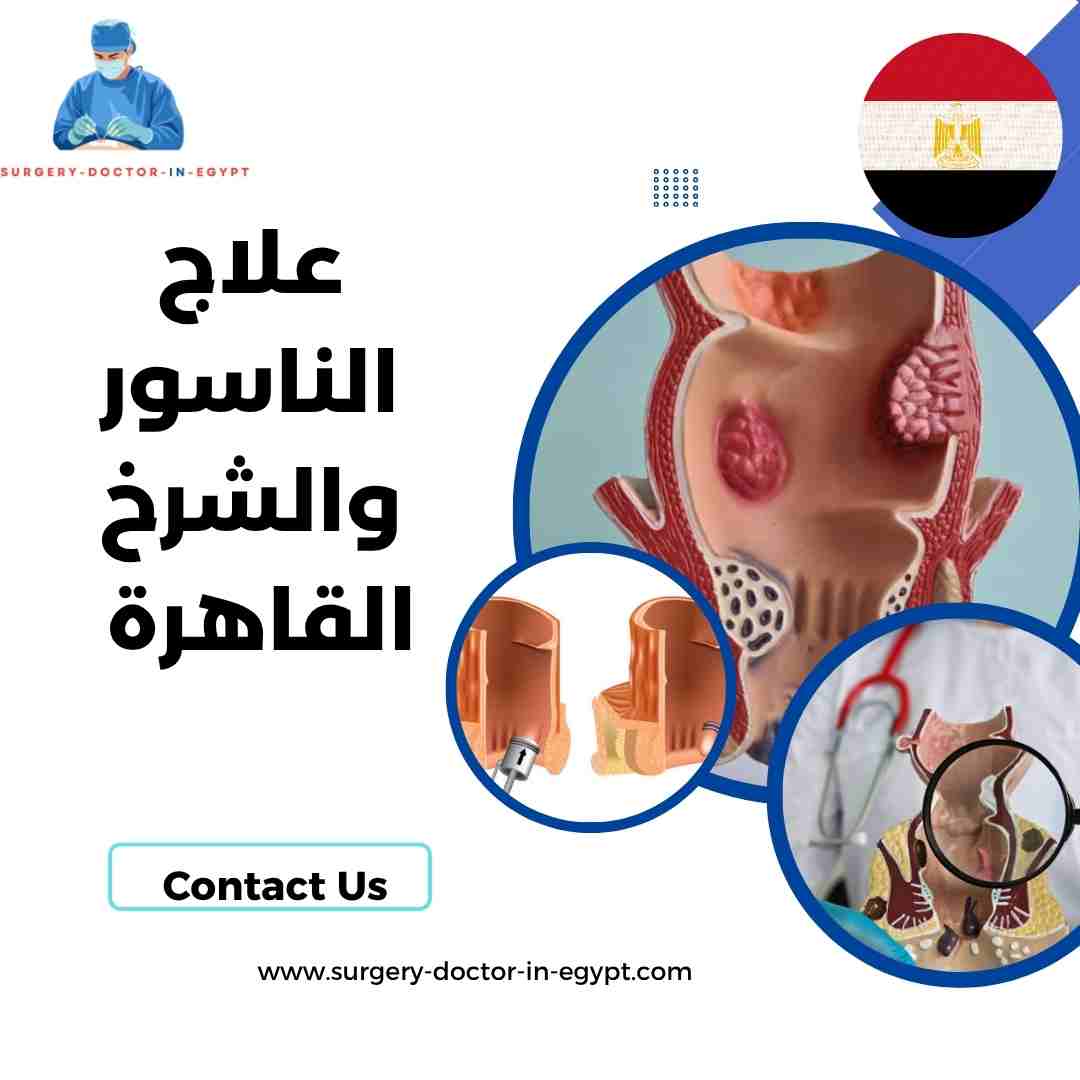 علاج الناسور والشرخ القاهرة