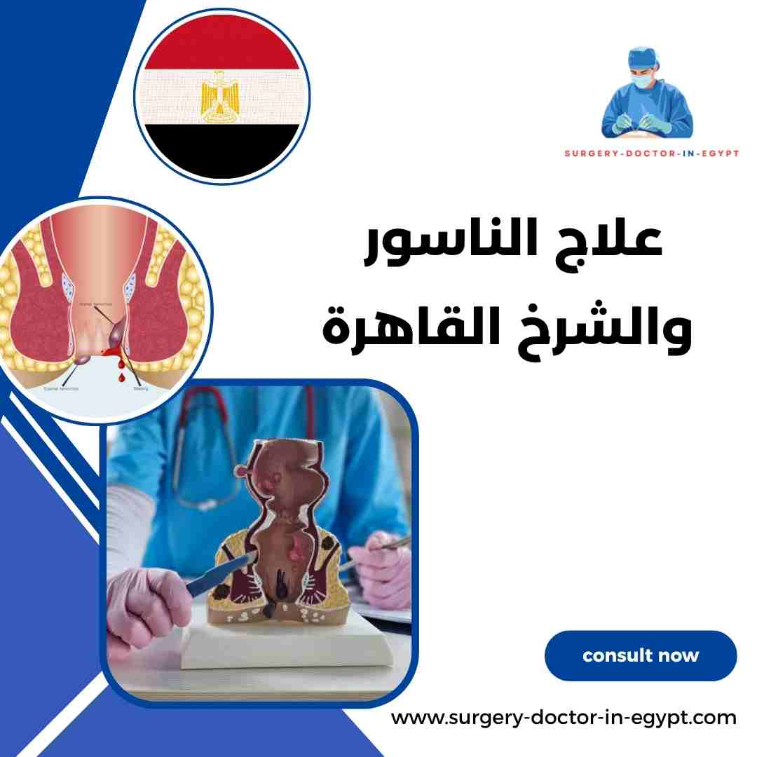 علاج الناسور والشرخ القاهرة