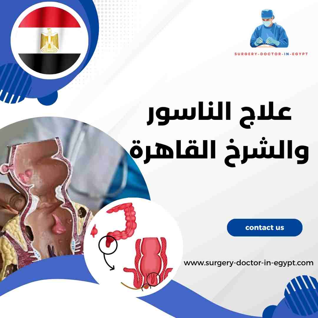 علاج الناسور والشرخ القاهرة