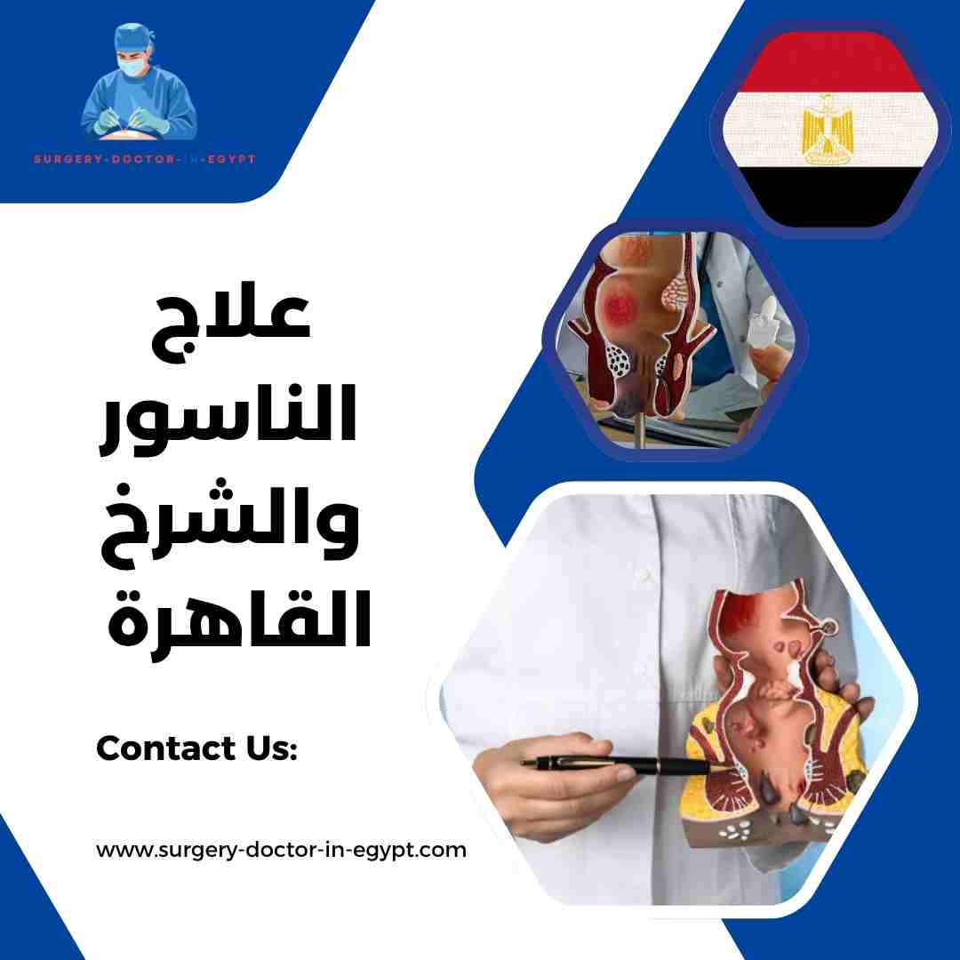 علاج الناسور والشرخ القاهرة