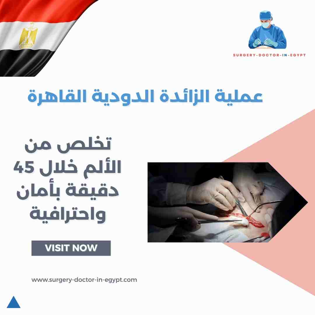 عملية الزائدة الدودية القاهرة