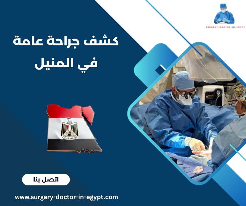 كشف جراحة عامة في المنيل